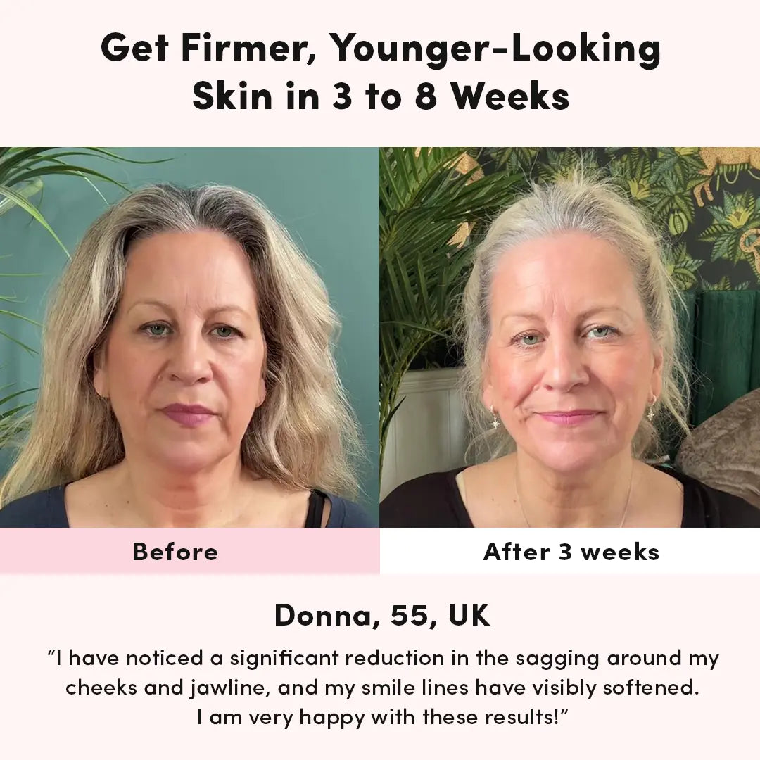 LUNA&SKIN RegenMask™